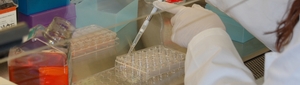 A new Non-Invasive Prenatal Diagnosis for Down Syndrome